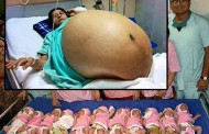 (Βίντεο) Γέννησε 11 αγοράκια, χωρίς καν καισαρική!