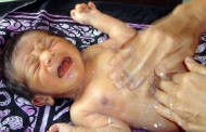 Ανόβερο: Ζωντανό μωρό βρέθηκε δίπλα σε σκελετό βρέφους μέσα σε βαλίτσα
