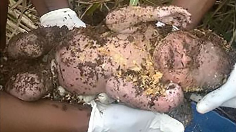 Φωτογραφία-σοκ: Εθαψε ζωντανό το μωρό της και οι συνάδελφοι της το έσωσαν τρεις μέρες μετά