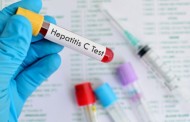 ΓΕΡΜΑΝΙΑ: Θεραπεία-εξπρές της οξείας ηπατίτιδας C